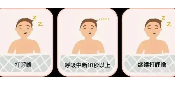 你真的了解睡眠呼吸暫停嗎？6600萬(wàn)中重度患者正在受害！—仟龍醫(yī)療