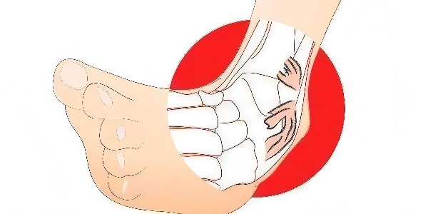 踝關(guān)節(jié)扭傷后的最佳應(yīng)對指南：簡單四步，助力快速康復(fù)！